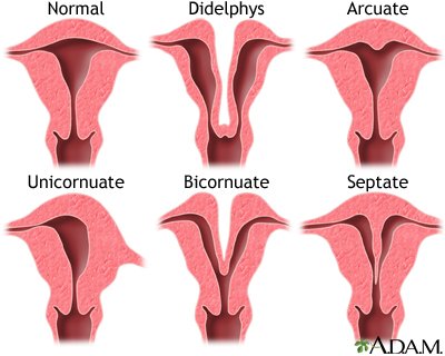 Anomali Uterus | Dunya Wanita